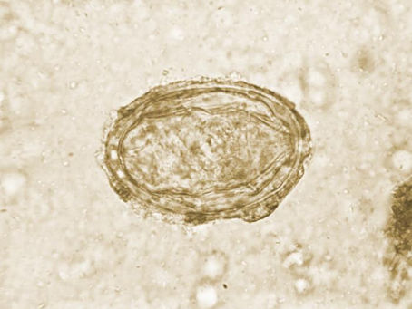 O. Quadrosi anfitrión de Schistosoma Japonicum