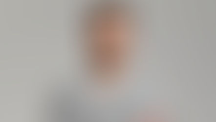 Revitalize Your Appearance – Unveiling Dr. Maxim Ivanchuk’s Face Your Face 25