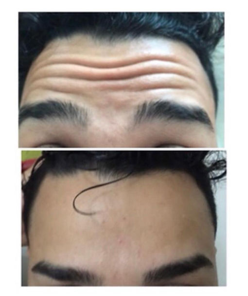 Exemplo do trabalho.jpeg