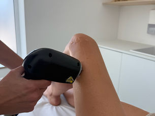 Epilation définitve à Boncelles Skin Center