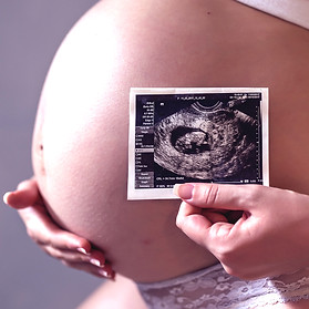 pregnant-woman-holding-photo-her-future-