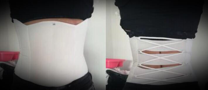 Miniatura: Fajas en yeso: Cinturilla, para pierna y brazo