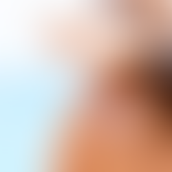 Como proteger sua pele no verão 