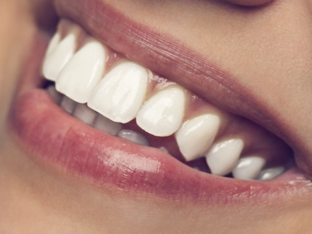 How Safe Is the Best Teeth Whitening Treatment for Sensitive Teeth?