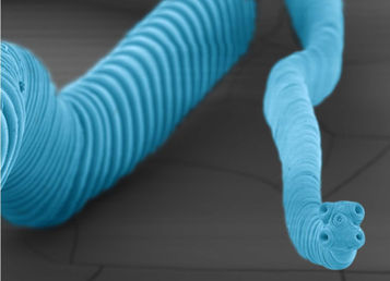 Parásitos y cáncer ¿tienen alguna relación?