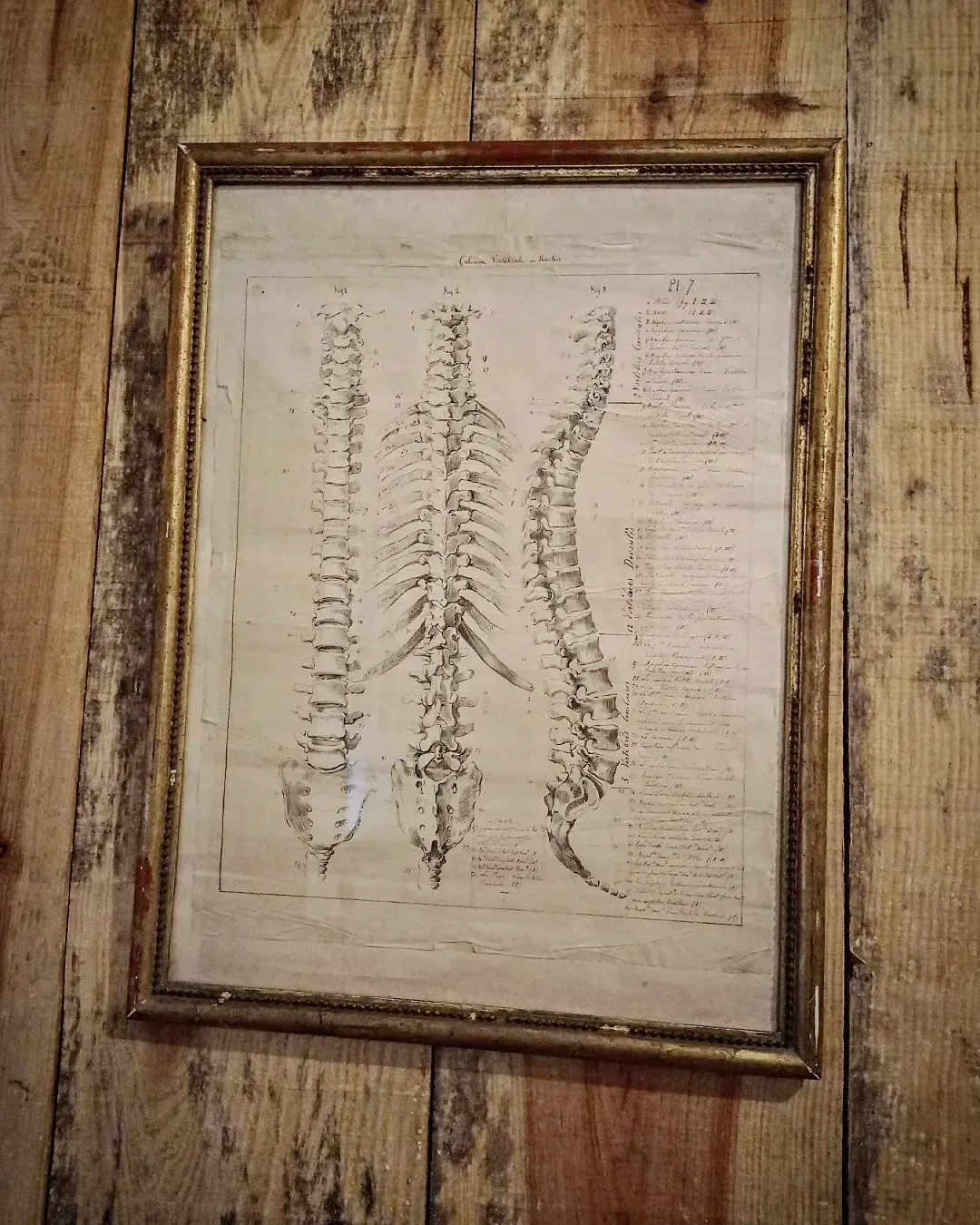 Dessin anatomique colonne vertébrale du XVIIIE siècle 