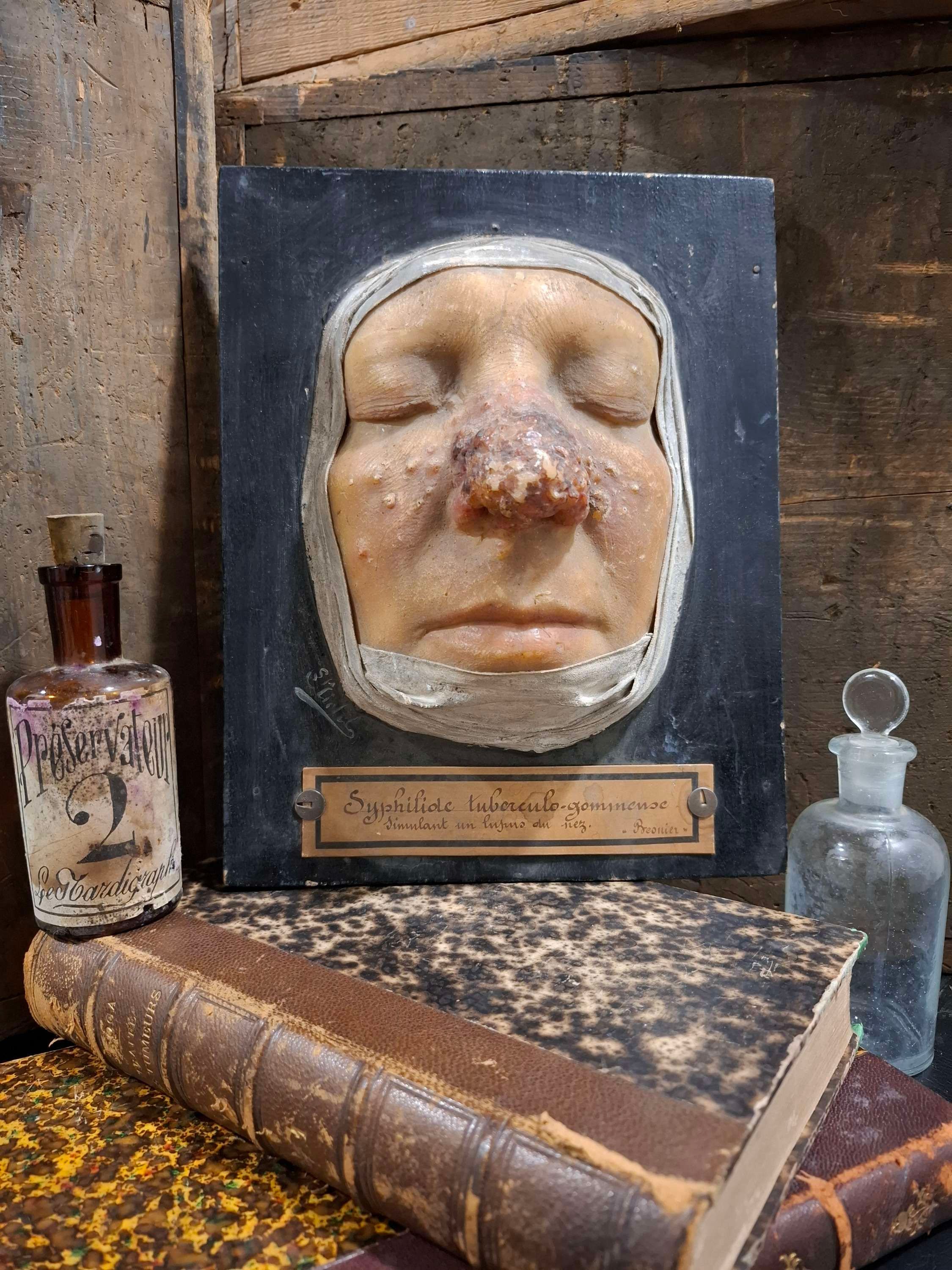 Cire dermatologique de 1893