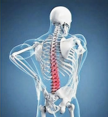 Rückenschmerzen Hexenschuss Schmerzlinderung mit neuen Methoden Bösch Personal Training Basel