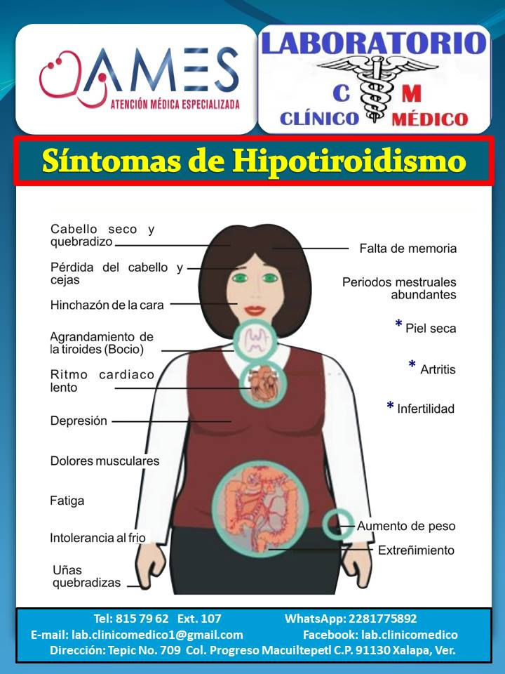 Hipotiroidismo