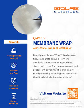 Membrane Wrap 1.jpg