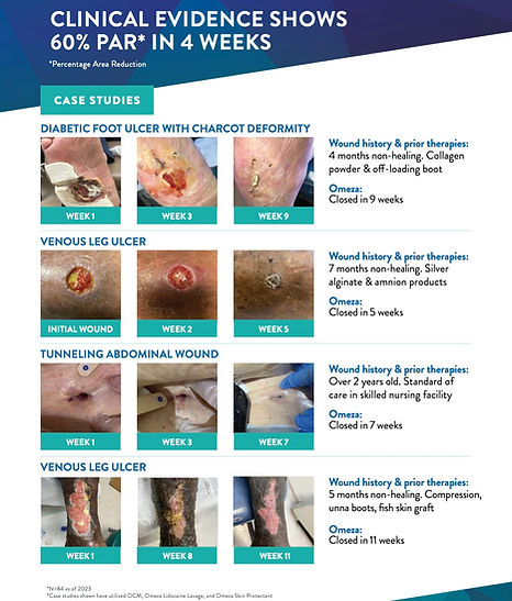 Omeza Clinical Evidence.jpg