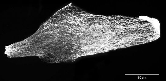 Tensile expansion microscopy applies mechanical force to super-resolve fixed and image live cellular samples