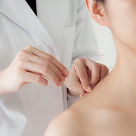 Acupuncture Session