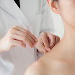 Acupuncture Session