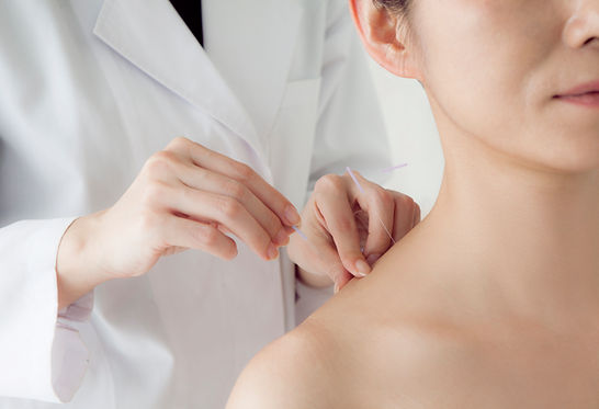 Acupuncture needles in shoulder