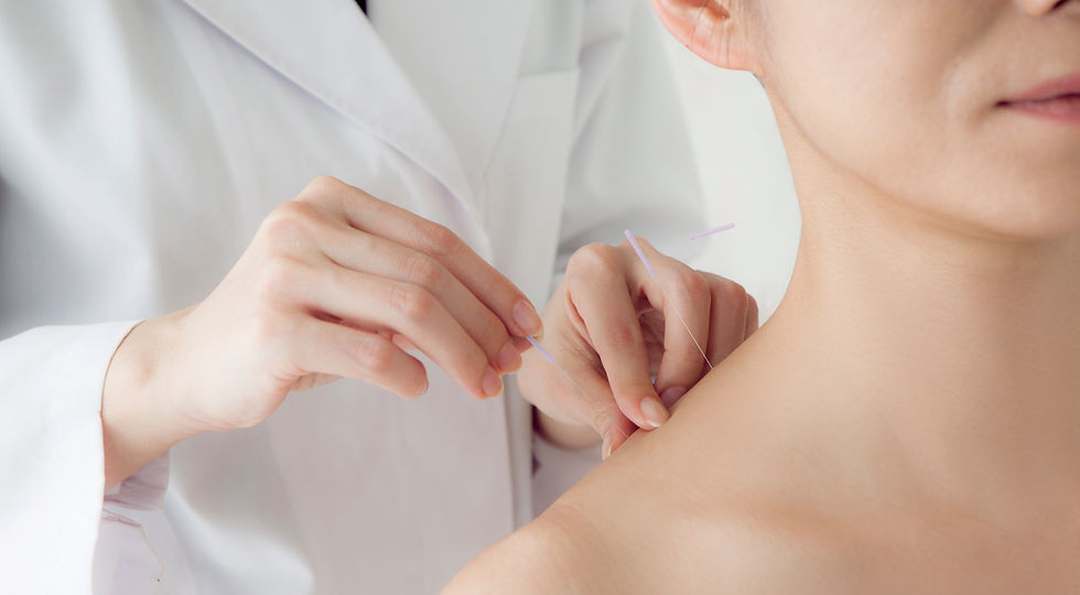 Acupuncture treatment