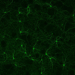 Primary Neurons in culture