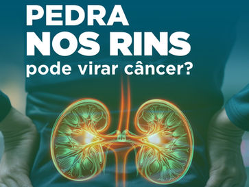 Pedra nos rins pode virar câncer? 