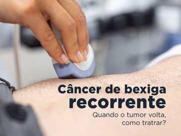 Câncer de bexiga recorrente: quando o tumor volta, como tratar?