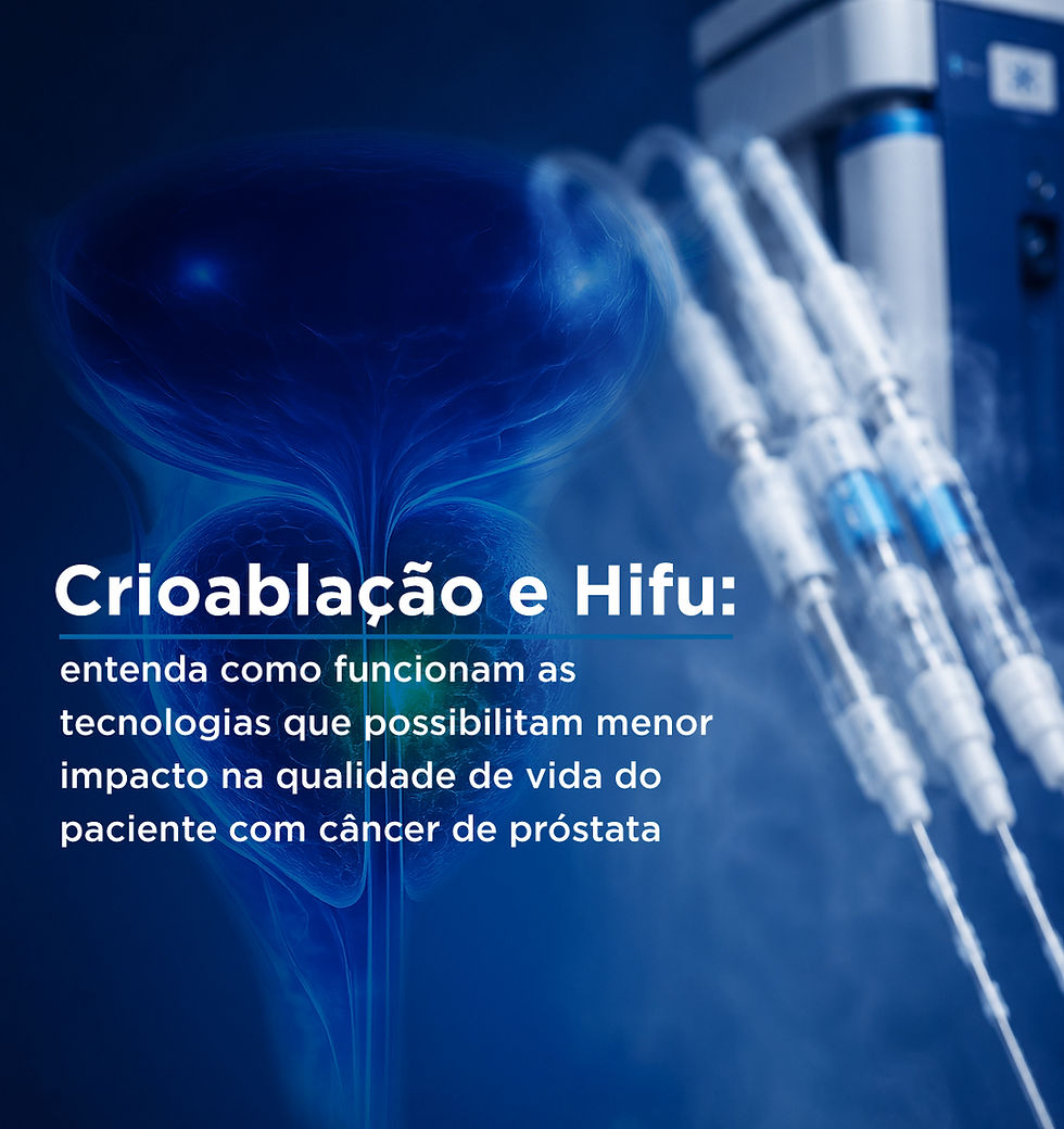 Crioablação e Hifu: entenda como funcionam as tecnologias que possibilitam menor impacto na qualidade de vida do paciente com câncer de próstata