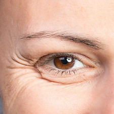 crows feet.jpeg