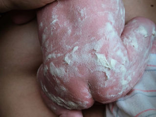 The Magic of Vernix