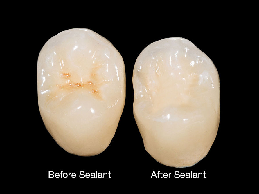 MacArthur Park Dentistry in Las Colinas & Irving, TX 75063 Family Emergency Dental Implants Invisalign Dentist - Dental Exams, Cleanings, Dental Crowns, Fillings, Bridges & Partials, Bonding, Teeth Whitening, Invisalign, ClearCorrect, Root Canal Therapy, Tooth Extractions, Veneers, Inlays & Onlays, Kid Friendly Dentistry