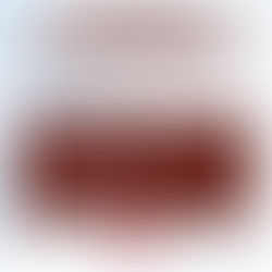 Fique de olho nas restrições para acompanhantes.