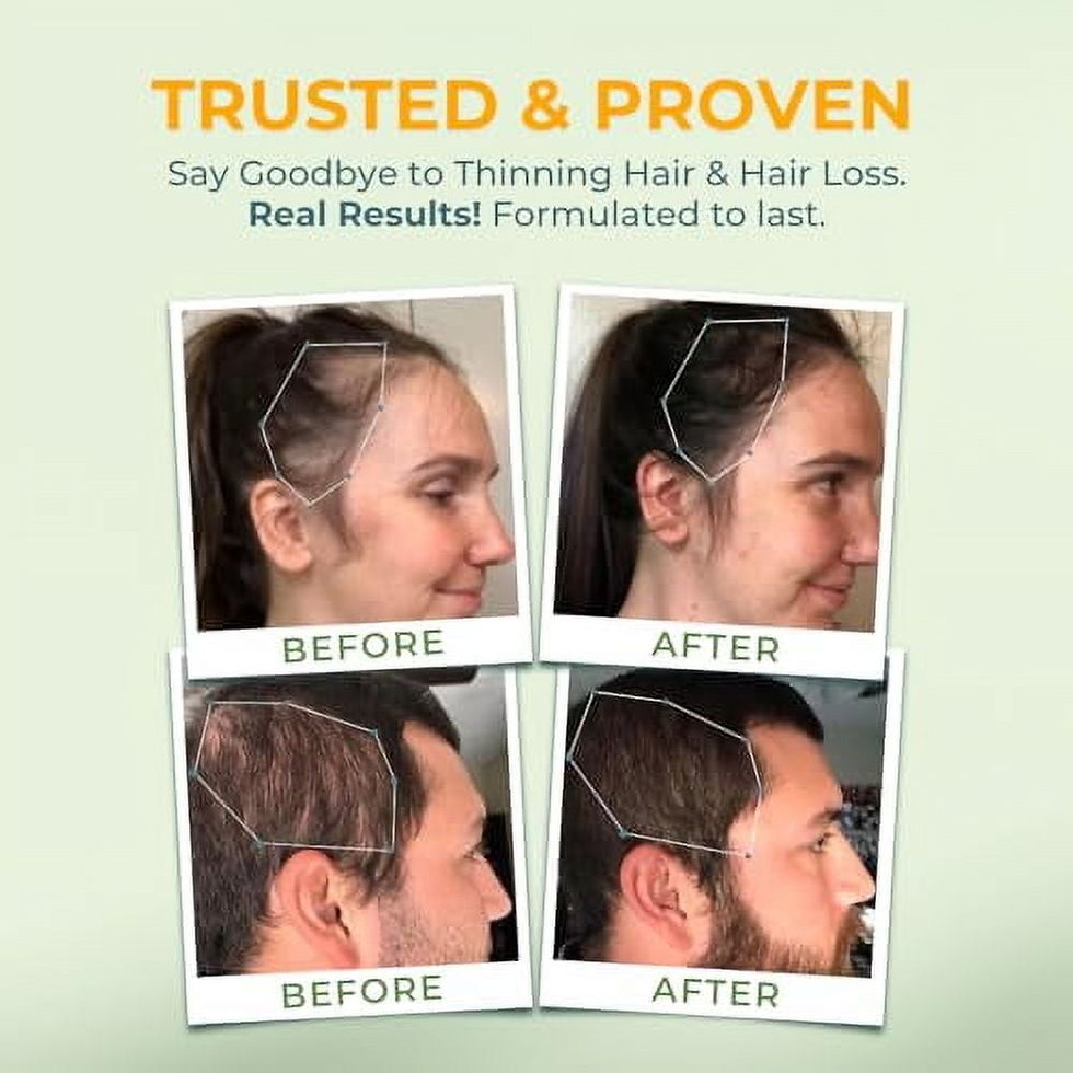 Thumbnail: VITAL NUTRITIVE Vital Hair Complex -Hair Growth Vitamins for Women and Men -Biot