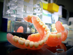 οδοντοτεχνογνωσία θερμοπλαστικά