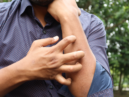 Food triggers vs eczema flare-ups