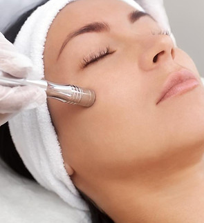 microdermabrasion.jpg