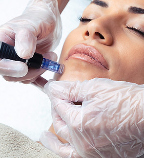 microneedling-hautarzt-zurich-2.jpg
