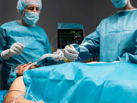 colon cancer surgery