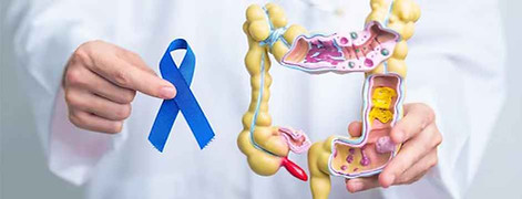 colorectal cancer_11zon.jpg