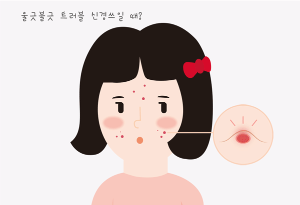 1_시카밤_커버밤_조성아_비비스틱_김고은_멀티밤_BB_상세페이지_02.gif