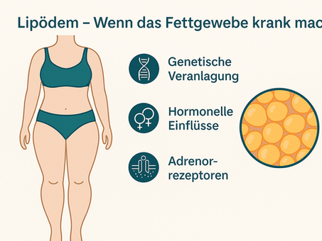 Lipödem – Wenn das Fettgewebe krank macht