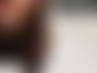 Foliculite na Barba, Como evitar?