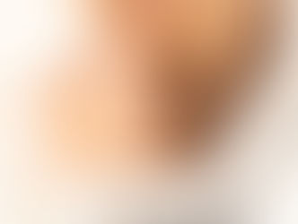 Cicatriz, saiba mais