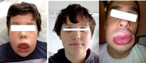 images (1).jpeg