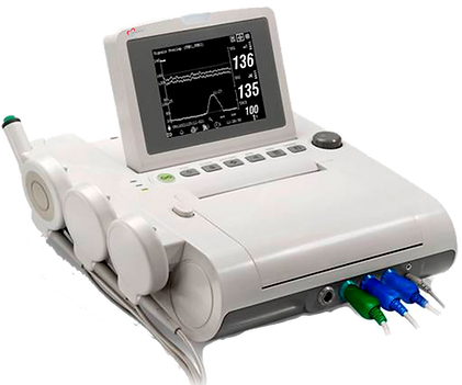 Tococardiografo