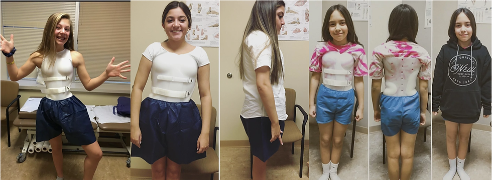 wilmington scoliosis braces