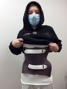 Rigo cheneau scoliosis brace delivery at the Eschen office in a Hospital for Special Surgery (HSS) in New York City (NYC)