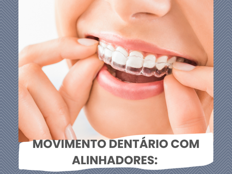 Movimento Dentário com Alinhadores Transparentes EVOAligner