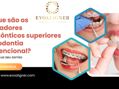 🦷 Porque os alinhadores ortodônticos são superiores à ortodontia convencional?