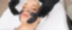 carbon facial.webp