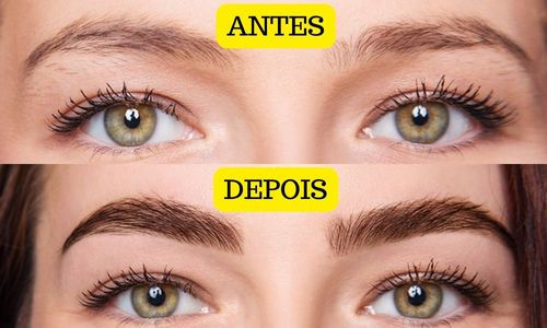 Minoxidil Para Sobrancelha Crescer Funciona?