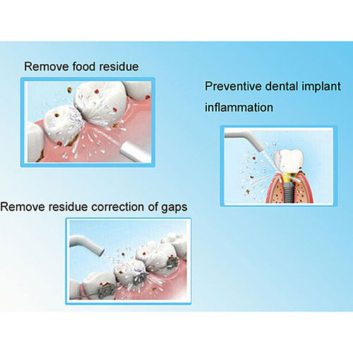 Thumbnail: POWER FLOSS