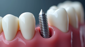 Explore the Benefits of Dental Implants: A Path to a Confident Smile