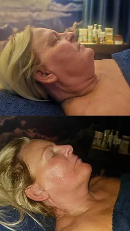 Lymphatic facial, Bishopbriggs, Glasgow, Facial